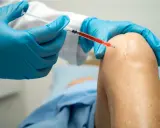 Lekarz w niebieskich rękawiczkach wykonuje zastrzyk w kolano pacjenta. Widać bliznę po wcześniejszej operacji.